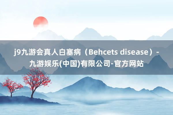 j9九游会真人白塞病（Behcets disease）-九游娱乐(中国)有限公司-官方网站